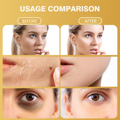 Bee Venom Skin Treatment Cream  & Skin Brightening